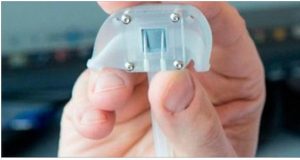 bionic kidney